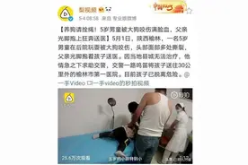 5岁男童脸被狗咬伤，父亲光脚狂跑送医，医生看了吓一跳图片