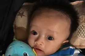 4个月脑瘤婴儿半年开颅5次 90后新手父母带儿披荆斩棘图片