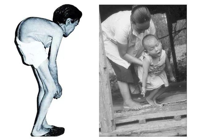 孩子多动、注意力不集中、记忆力不好，原来这些东西在伤脑