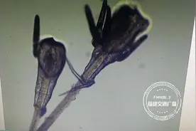 福州一女子狂掉眉毛，一查竟发现是螨虫作祟！医生:要选择正规的医疗机构做项目图片