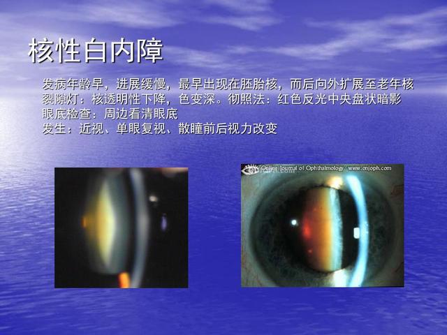 沃纳综合症，生化检查需分析患者血脂，以及尿肌酐，氨基酸的情况