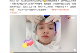 90后女星追捧的“热玛吉”，是抗衰老神器吗？图片