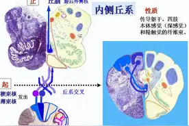 脑干、小脑及间脑解剖图片