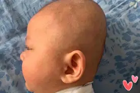 为啥“扁头”独得老人恩宠，难道比圆头更聪明？不，扁头只会坑娃图片