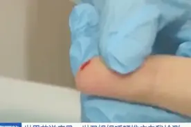 个人用唾液或指尖采血可了解艾滋病感染状况，20分钟内可出结果视频封面