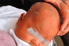 宝宝满月被奶奶剃光头，头发就再没长，送医检查医生怒斥：太无知图片