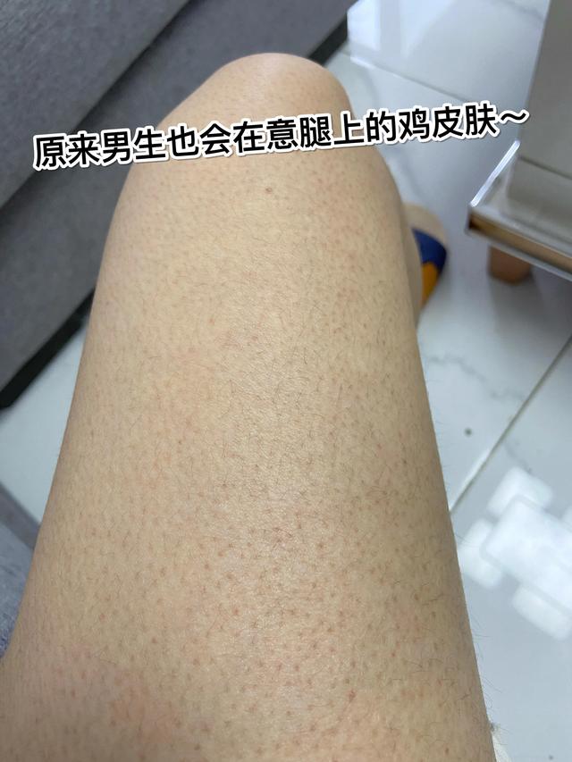 磨砂膏擦鸡皮肤的方法