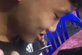 广东一男子吃钉螺反被钉螺紧紧吸住下嘴唇，哈喇子都快流出来图片