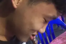 广东一男子吃钉螺反被钉螺紧紧吸住下嘴唇，哈喇子都快流出来图片