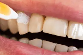 每天都刷牙，为何牙齿还糊着一层“臭泥”？这3件事是否做到位图片