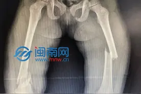 泉州一女司机，开车走神撞树，一大家子4人受伤！图片