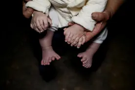 3个月大的男婴为何长出31根指头？得知原因后母亲崩溃痛哭图片