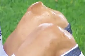 胆小勿进 足球场上的那些断腿瞬间 看着都疼视频封面