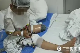 左腿截肢！6岁男童被火车撞断腿！家长质疑：娃怎么会中午跑出幼儿园？图片