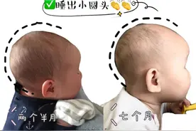 怎么给宝宝睡出好头型！舟状头矫正图片