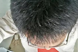 长白头发不仅仅是因为年纪大了，还有可能是别的原因，你是哪种？图片