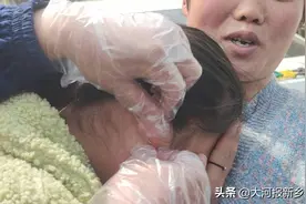 耳钉会“咬”人 消防员小哥哥：拆图片