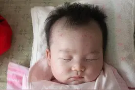 3岁女童一个动作，导致下肢受伤，医生：别小看这个行为图片