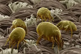 洗澡搓下来的黑泥到底是啥？显微镜放大100倍，看完一阵恶寒图片