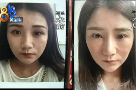 整容后感觉老十岁，“本来我看起来很年轻的”图片