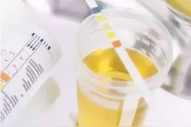 一公斤5元，高价回收孕妇的“尿液”！孕妇的“尿液”有何用途？图片