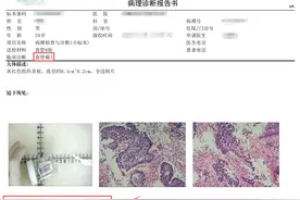 39岁男子确诊食管癌，出现这“三感一痛”要警惕图片