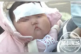 南昌5月龄宝宝体重飙升至20斤，宝妈怀疑面霜有问题：脸越来越大图片