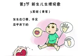 新生儿特殊生理现象之眼白出血？图片