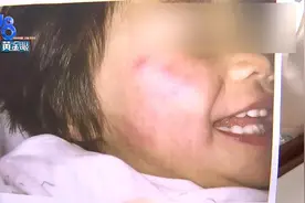 一岁宝宝化妆拍写真后过敏，店方：都是正规化妆品图片