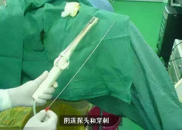 取卵后喝板栗花胶乌鸡汤吗 取卵后喝板栗花胶乌鸡汤吗有影响吗