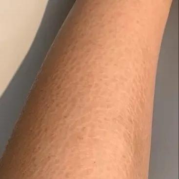 野脚鸡皮肤穿裙子 野脚鸡皮肤穿裙子