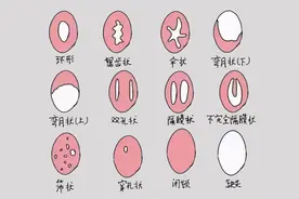 女性第一次一定会出血？这层膜到底有什么用？很多男人误解了图片