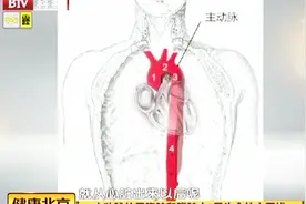 人体中最粗的血管是哪一根？医生：直径可达3厘米视频封面