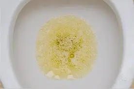 辟谣：尿液出现泡沫就是蛋白尿？一文跟你说清引起泡沫尿的原因图片