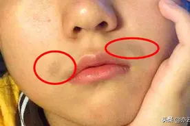 妇科问题，一看嘴巴就知道，看看你有没有？图片