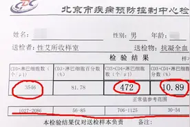 艾滋病会经历3个阶段，这些身体症状，思想开放的人要留意图片