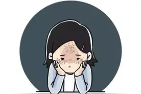 谁说色斑不能除？图片