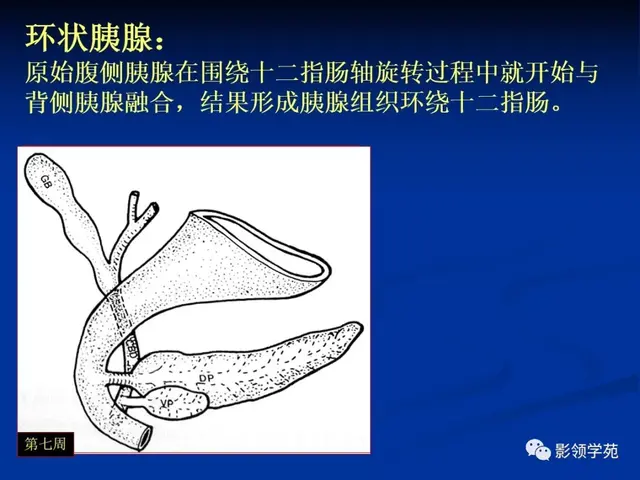 胰腺的解剖与常见变异