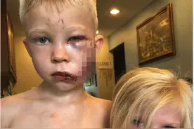 6岁男童为救妹妹勇斗恶犬，漫威英雄纷纷线上点赞图片