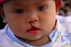 妈妈故意弄丢6岁"兔唇"女儿，20年后在人海中相遇，如今悔不当初图片