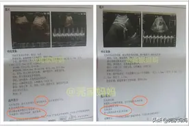 亲历：喝水不够导致羊水少，孕期饮水避5大误区，喝水指南请收好图片