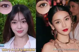 好多明星都做了开眼角，那开眼角和不开眼角有什么区别呢？图片