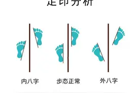 孩子这些习惯，可能会导致内八字、x型腿，应该要多注意了！图片