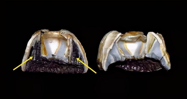 龟头里面有鸡皮疙瘩