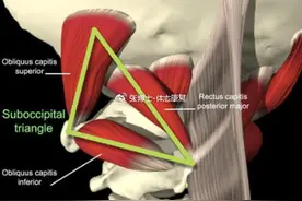「译文分享」枕下三角区与头痛的关系，枕下肌群的松解方法图片