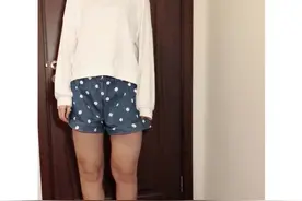 吸脂真的有效果吗？我做过的告诉你图片
