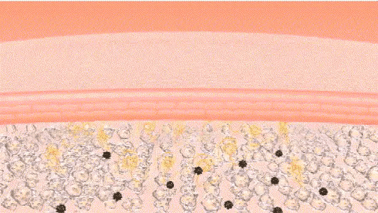 女生身上鸡皮肤好吗