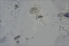 聚焦男人“裆下”健康，铁汉也需柔情呵护图片