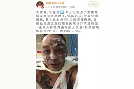 睡前点香薰蜡烛，一网络歌手被烧伤，记者走访福州市场图片