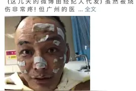 睡前点香薰蜡烛，一网络歌手被烧伤，记者走访福州市场图片